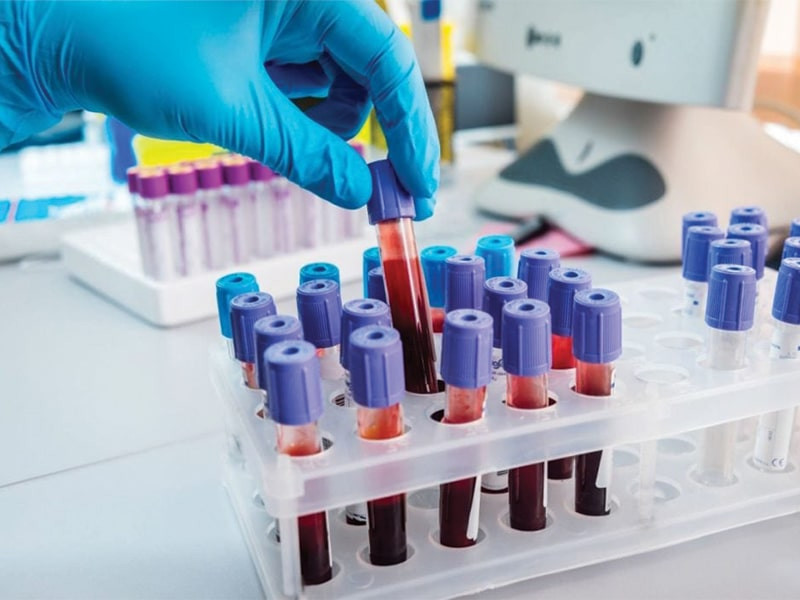 Il nuovo Laboratorio Analisi Bio Clinic a Sassari è stato inaugurato offrendo una vasta gamma di servizi diagnostici avanzati con tecnologia all'avanguardia. Operativo dal lunedì al venerdì dalle 7:00 alle 21:00 e il sabato fino alle 17:00, risolvendo le problematiche legate gli orari dei lavoratori, il laboratorio si posiziona come un essenziale punto di riferimento per la salute della comunità locale. Situato in una zona facilmente accessibile, offre anche parcheggio gratuito per eliminare uno dei principali disagi per i pazienti. Tra i servizi offerti ci sono breath tests, test allergologici, e servizi per la gravidanza come il monitoraggio del diabete gestazionale. Il laboratorio punta a fornire diagnosi precoci e accurate, con la possibilità di prenotare appuntamenti online o tramite telefono. Con la sua ampia offerta e orari flessibili, Bio Clinic mira a migliorare la gestione della salute individuale e familiare a Sassari.